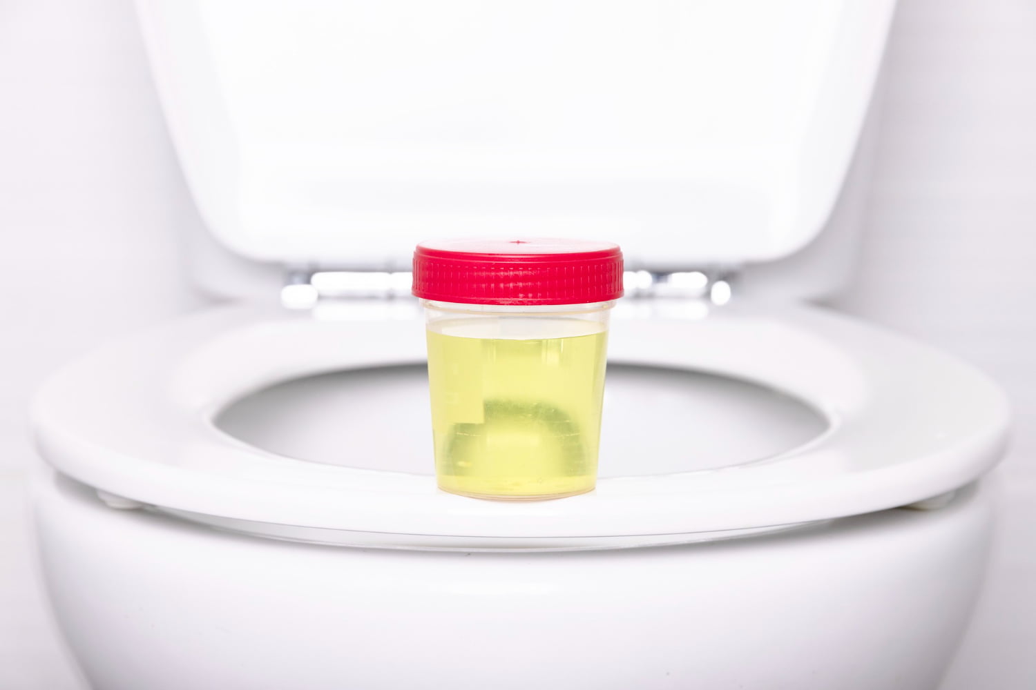 Urine qui sent fort quelles sont les causes ? Millastuces